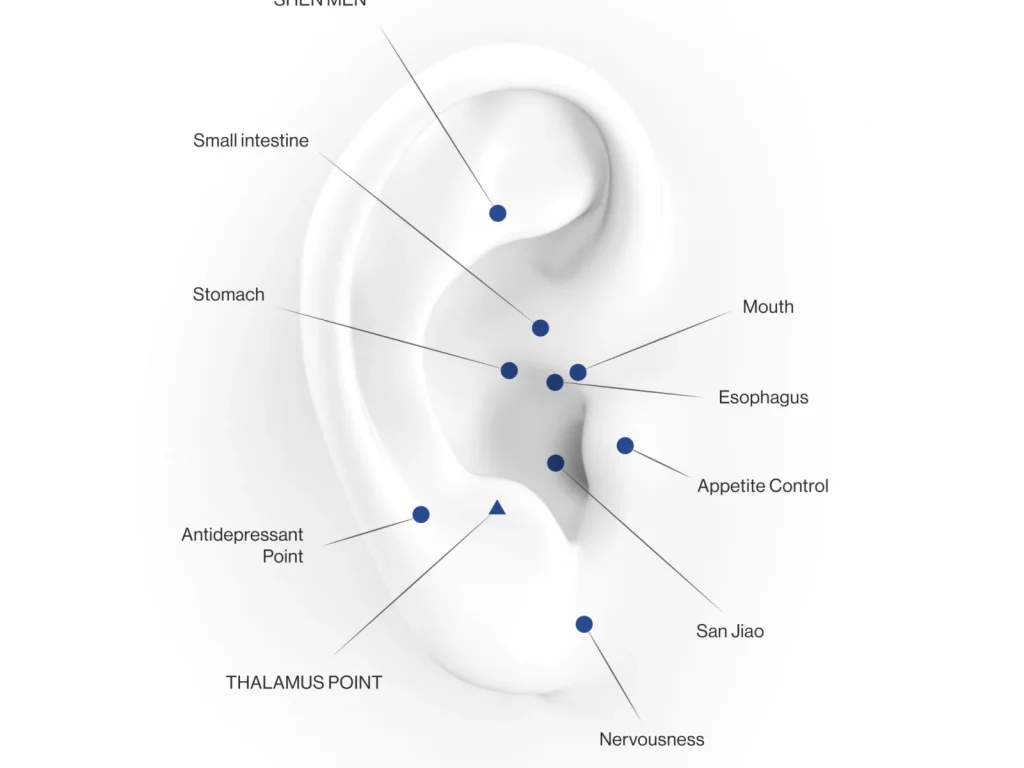 La médecine auriculaire