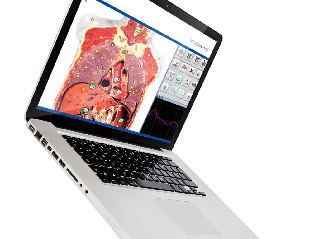 Scannage biorésonance