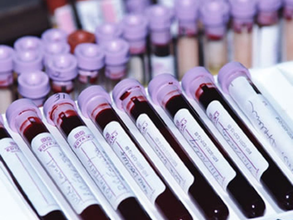 prélèvement sanguin