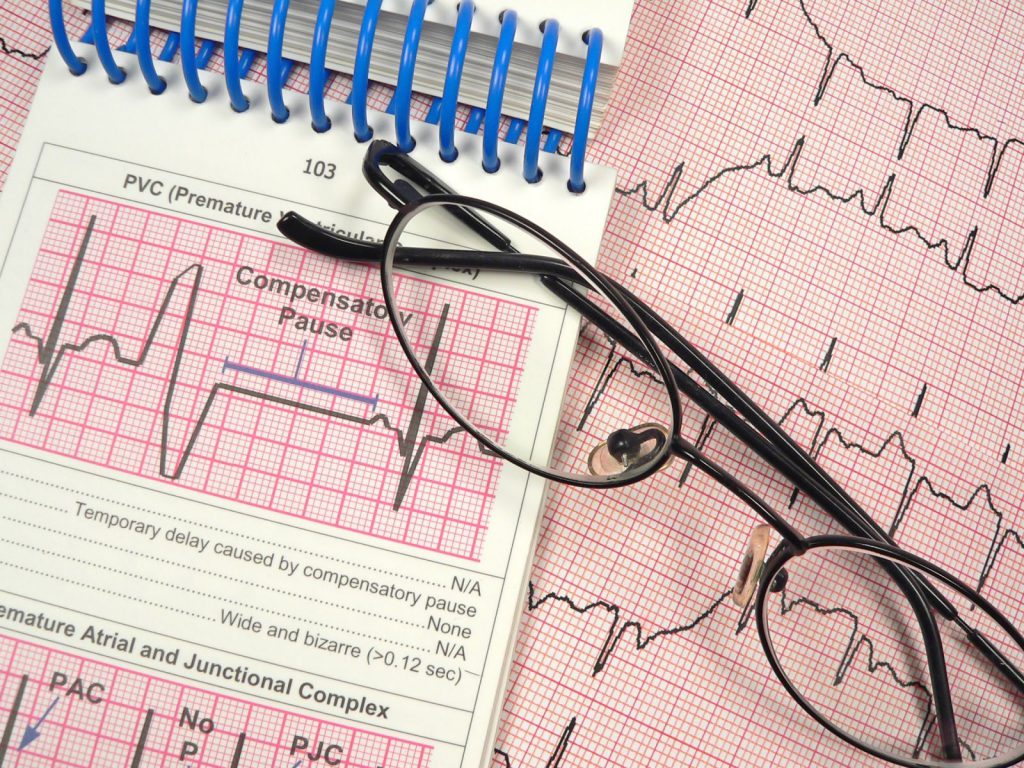 électrocardiogramme